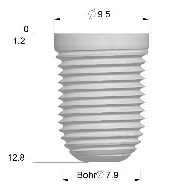 Implantat mehrteilig Oversize X L11, IM-OX-L11